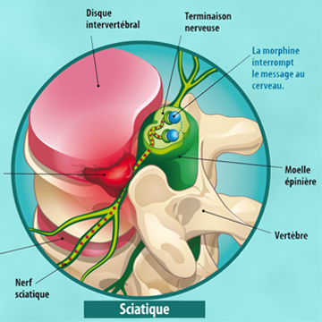 Illustration technique anatomique